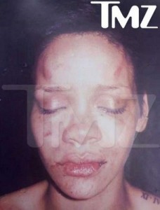 rihanna-battered-photo